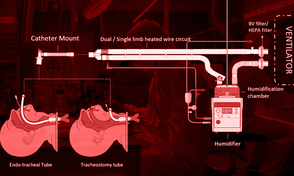 mechanical ventilator